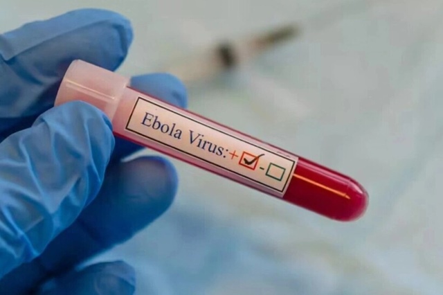 Bộ Y tế yêu cầu theo dõi người nhập cảnh từ vùng có dịch Ebola
